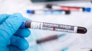 1763226553 منظمة الصحة العالمية تحذر من انتشار فيروس ماربورج بعد ظهور
