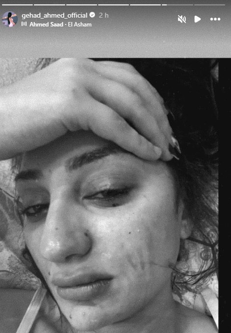 1763581657 247 جهاد أحمد توضح الأمور بعد انفصالها بدقائق وترد على الشائعات