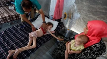 الأمم المتحدة الجوع في الدول العربية وصل لأعلى مستوى بسبب