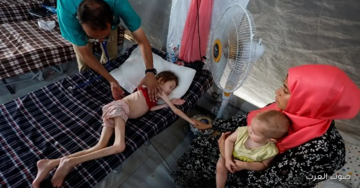 الأمم المتحدة: الجوع في الدول العربية وصل لأعلى مستوى بسبب الحروب والتغيرات المناخية