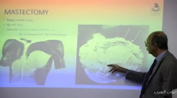 الصحة تجيب خبير مصري عالمي في جراحات أورام الثدي لتدريب