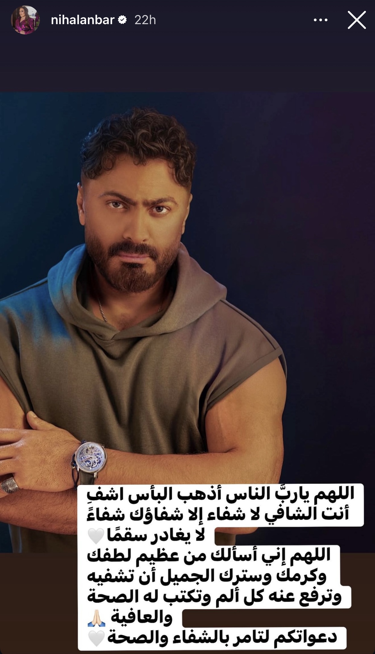 نهال عنبر تطلب الدعاء لتامر حسني بعد عملية جراحية دقيقة