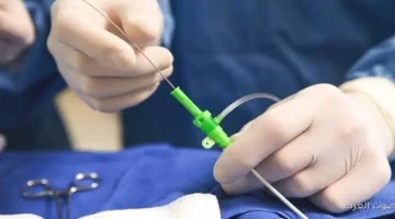 سيدة عندها 26 سنة تفاصيل تركيب 3 دعامات لمريضة في