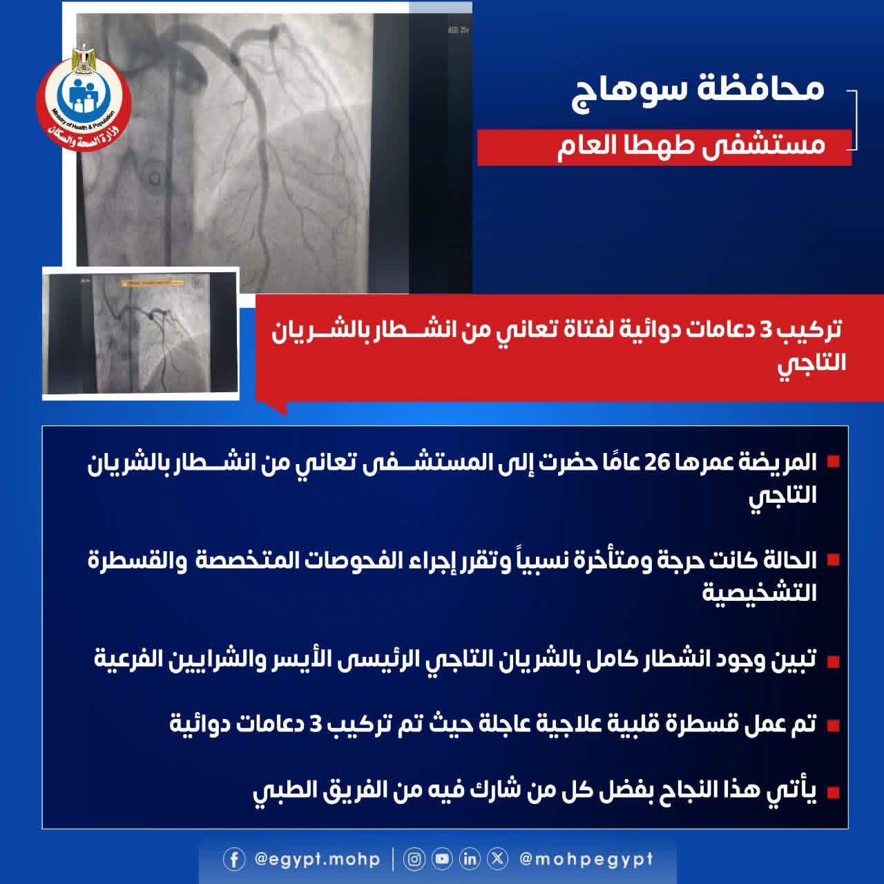 صورة لعملية تركيب الدعامات