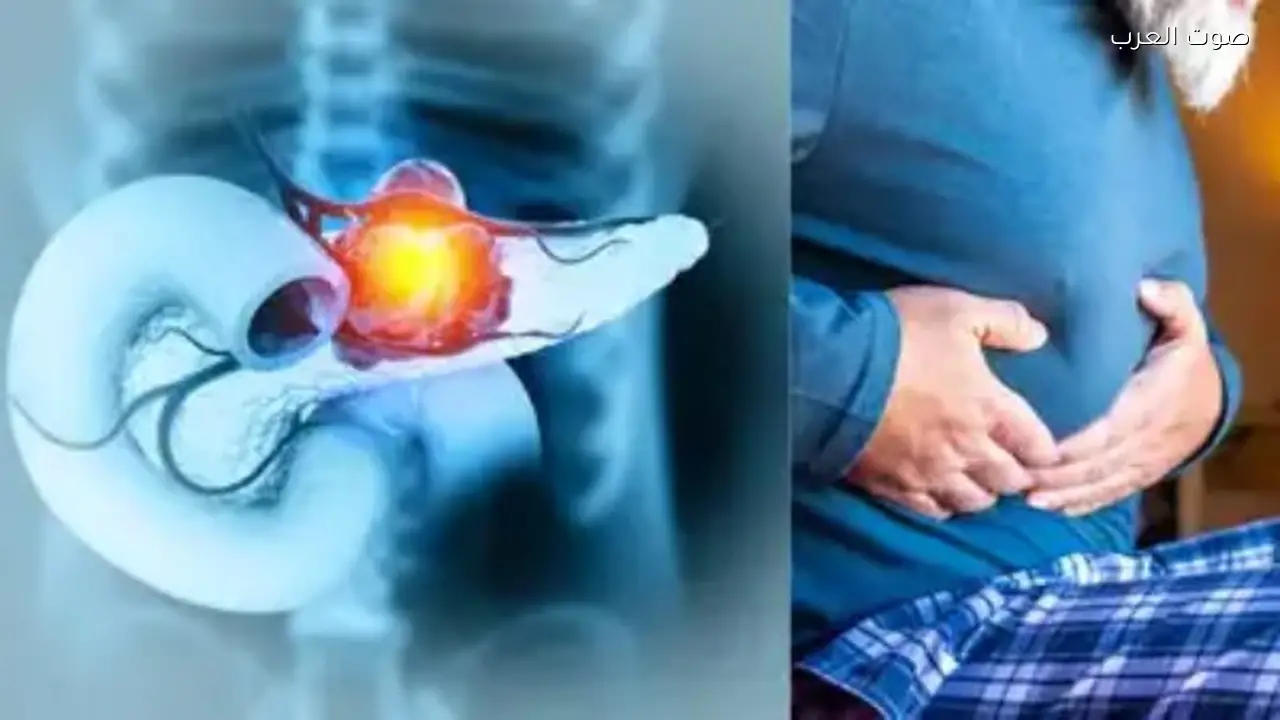 باحثون يبتكرون علاجًا جديدًا لسرطان البنكرياس