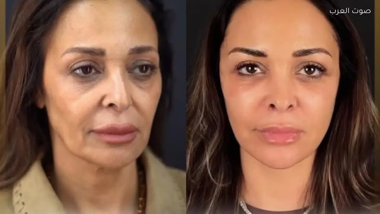 داليا البحيري تتصدر التريند بعد خضوعها لعملية تجميل