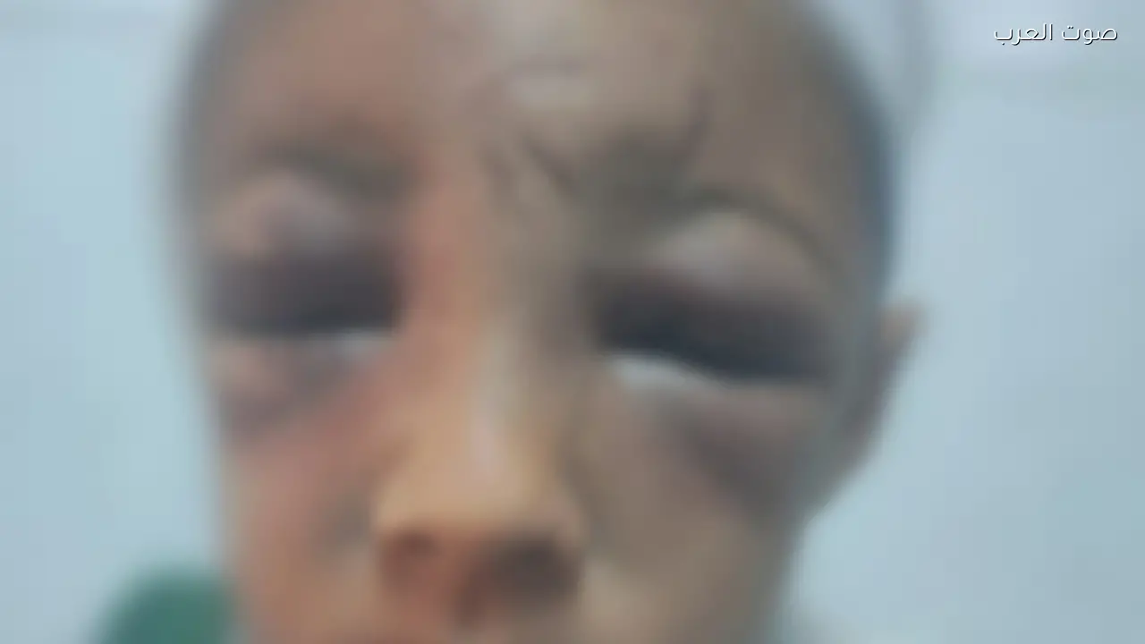 أب يعذب ابنه بسبب فقدان 10 جنيهات في المحلة