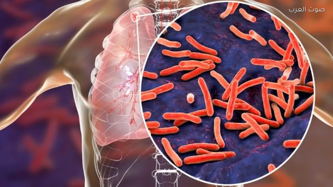 أعراض الالتهاب الرئوي ومؤشرات الخطر التي يجب معرفتها