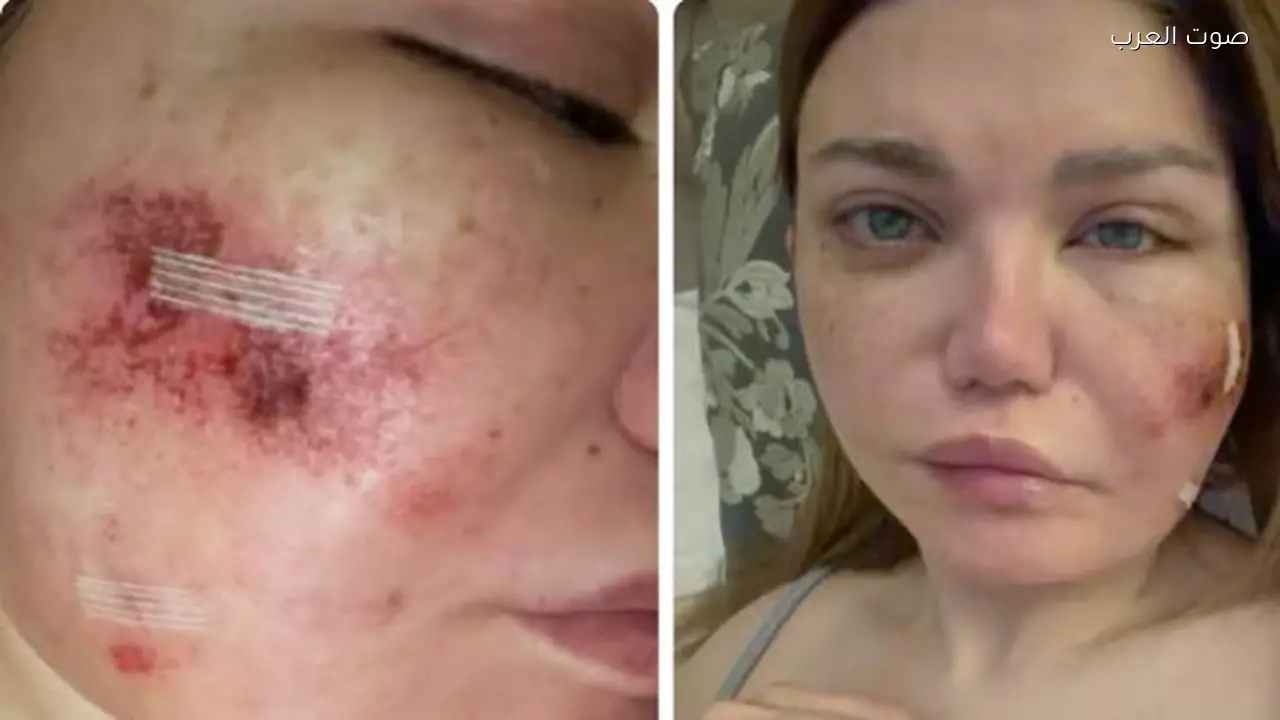 إعلامية شهيرة تخضع لجراحة عاجلة بسبب تورم مفاجئ في رمضان