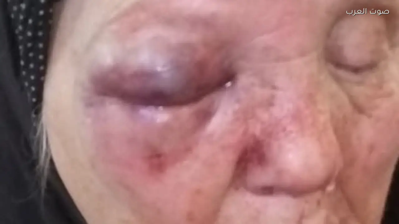 ابن يعتدي على والدته للحصول على أموال لشراء مخدرات في الغربية