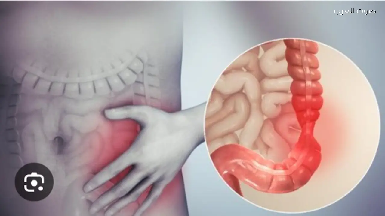 التهاب الأمعاء: حقائق مهمة تتجاوز مشاكل الهضم