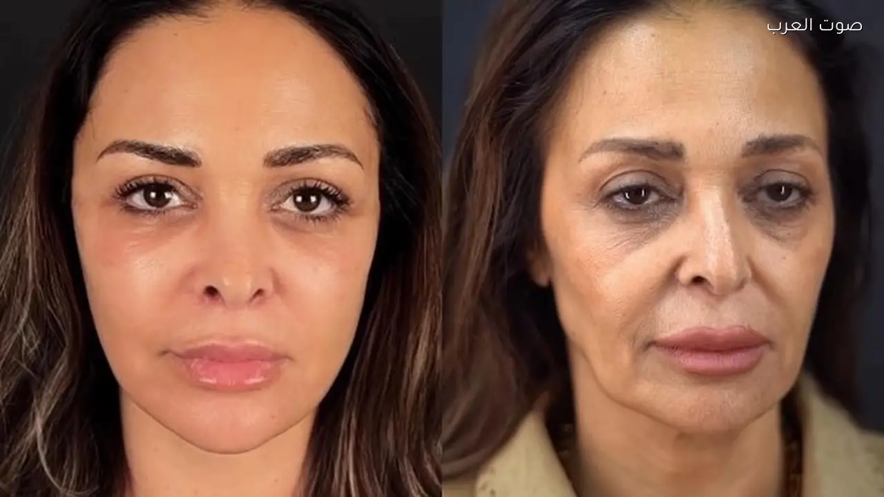 تفاصيل عملية تجميل داليا البحيري بعد تصدرها التريند