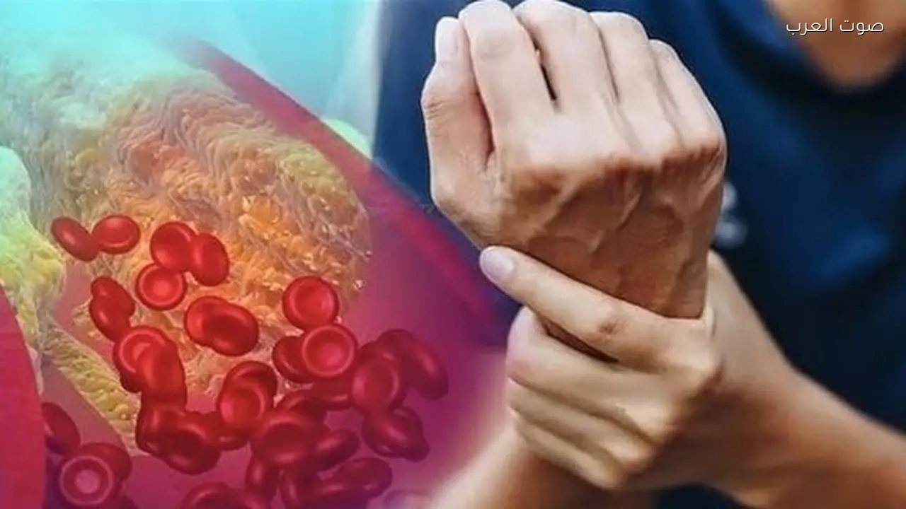 حبوب جديدة تخفض الكوليسترول حتى 60%