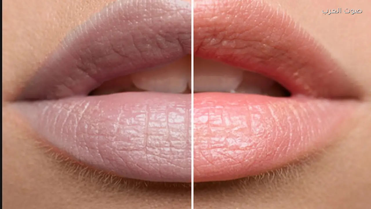 علاج إسمرار الشفاه بمكون واحد من خلال وصفتين بسيطتين