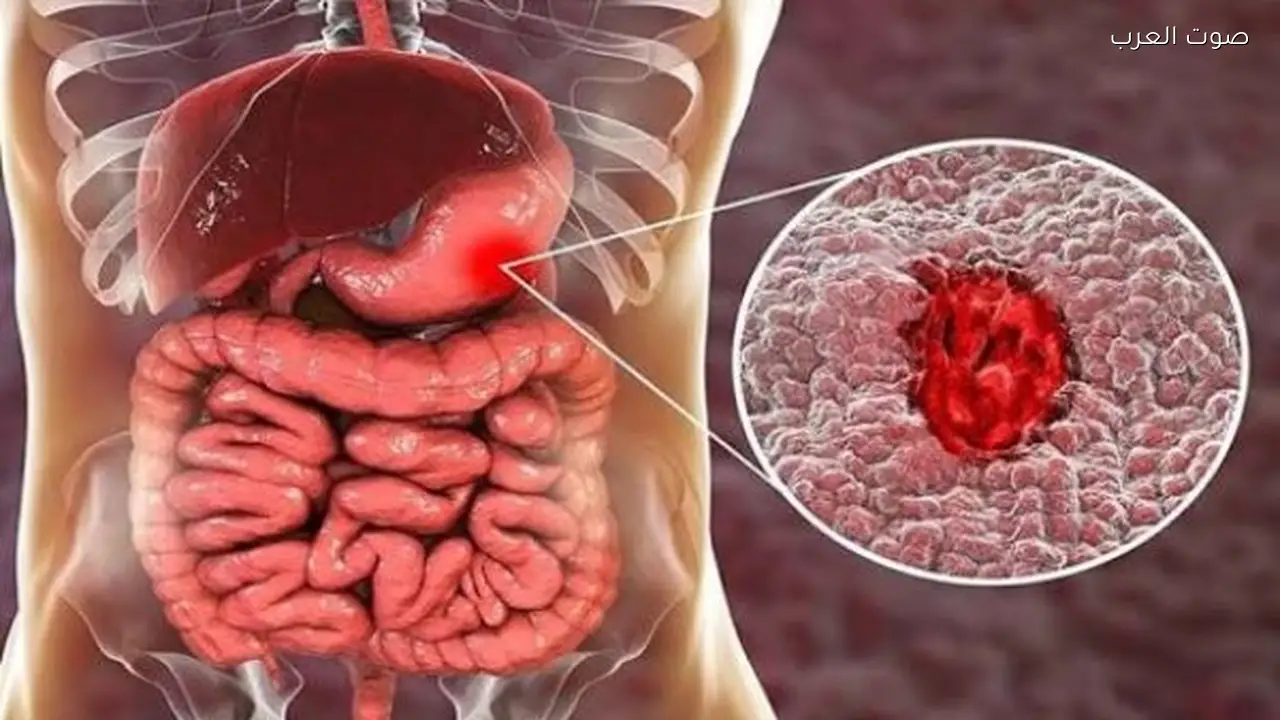 تأثير صيام رمضان على صحة القولون حسب طبيب مختص
