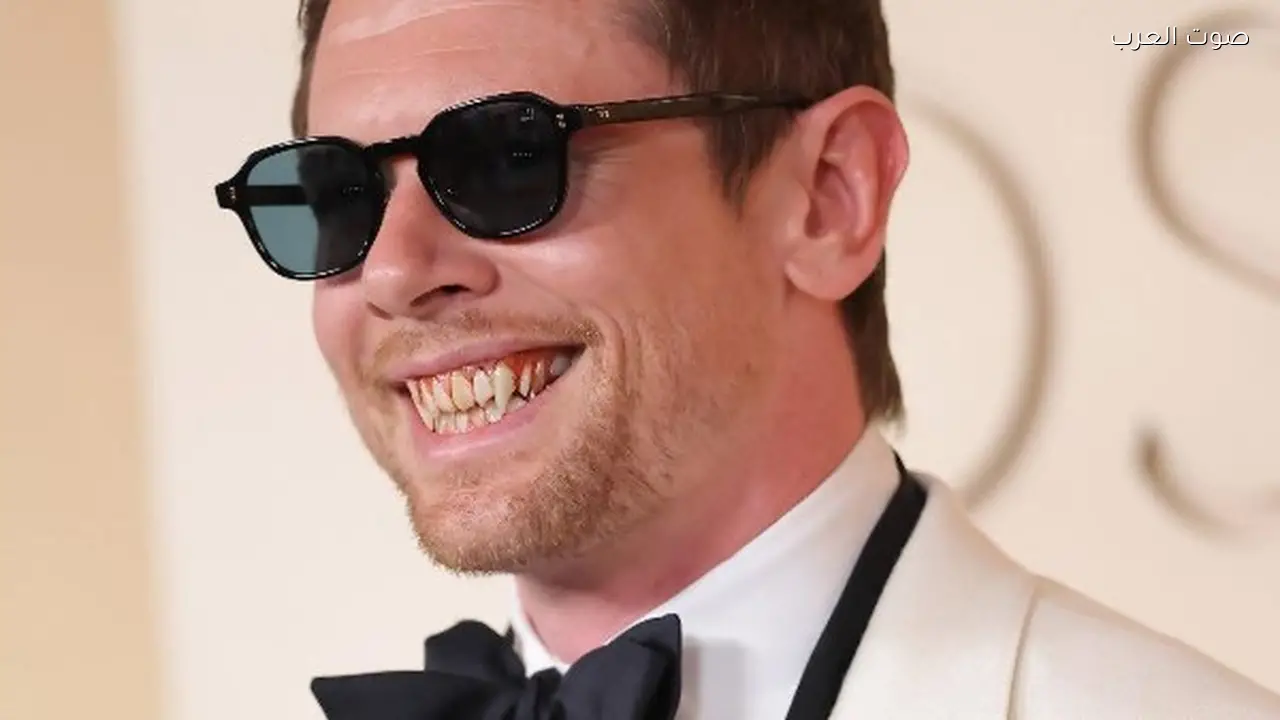 جاك أوكونيل يتألق بأنياب مصاصي الدماء في حفل الأوسكار