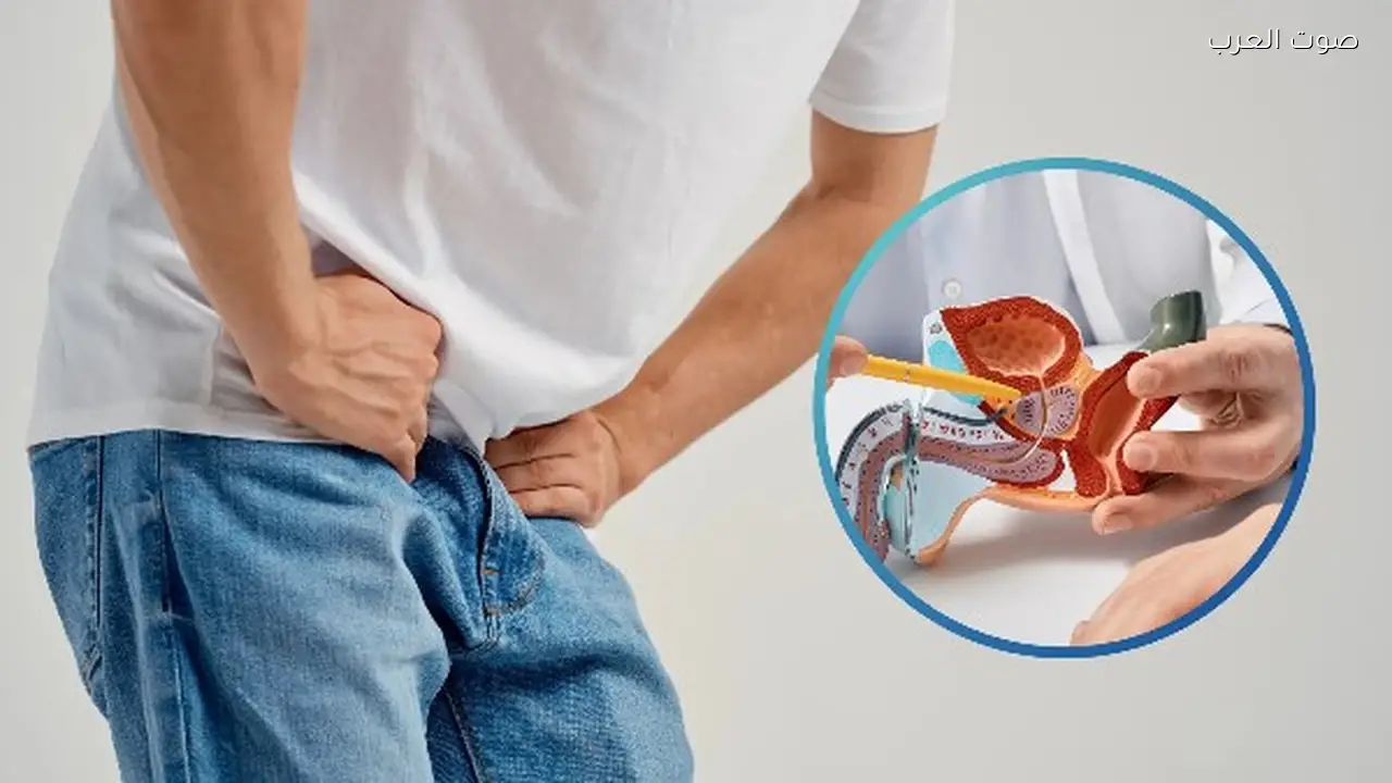 علاج التهاب البروستاتا بالأدوية والطب البديل