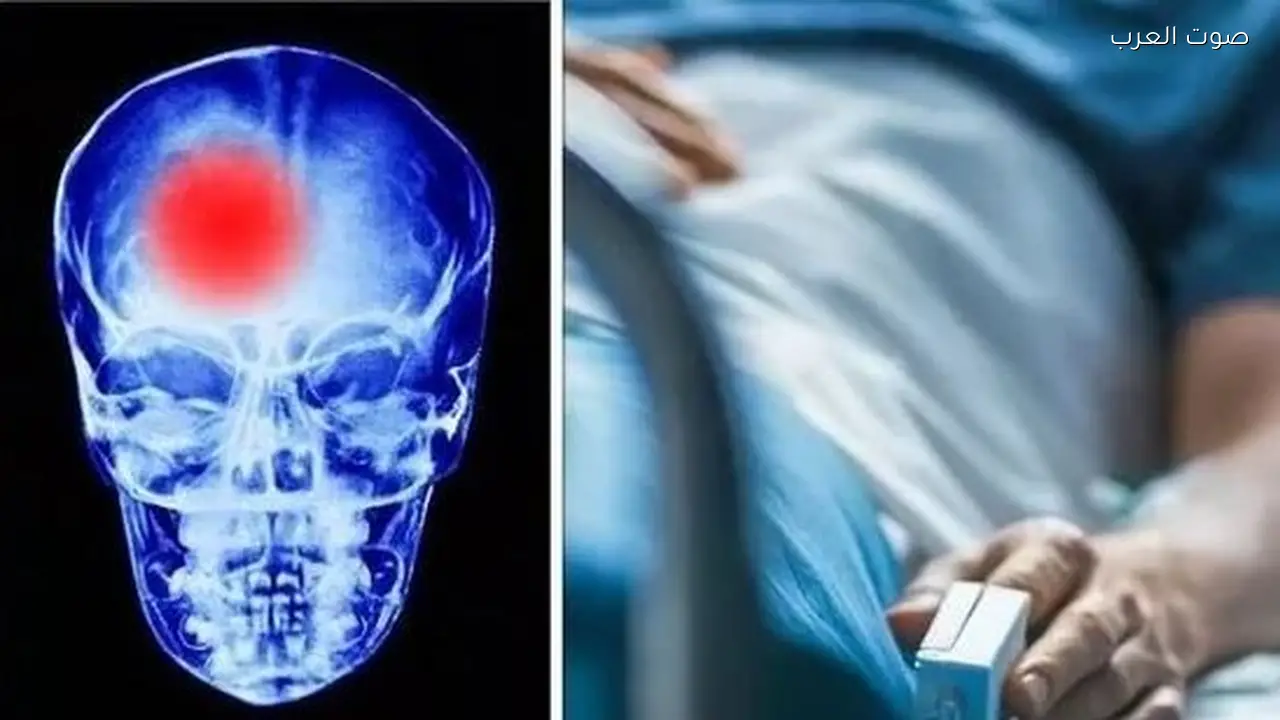 عوامل خطر تؤدي إلى جلطة الدماغ يجب معرفتها