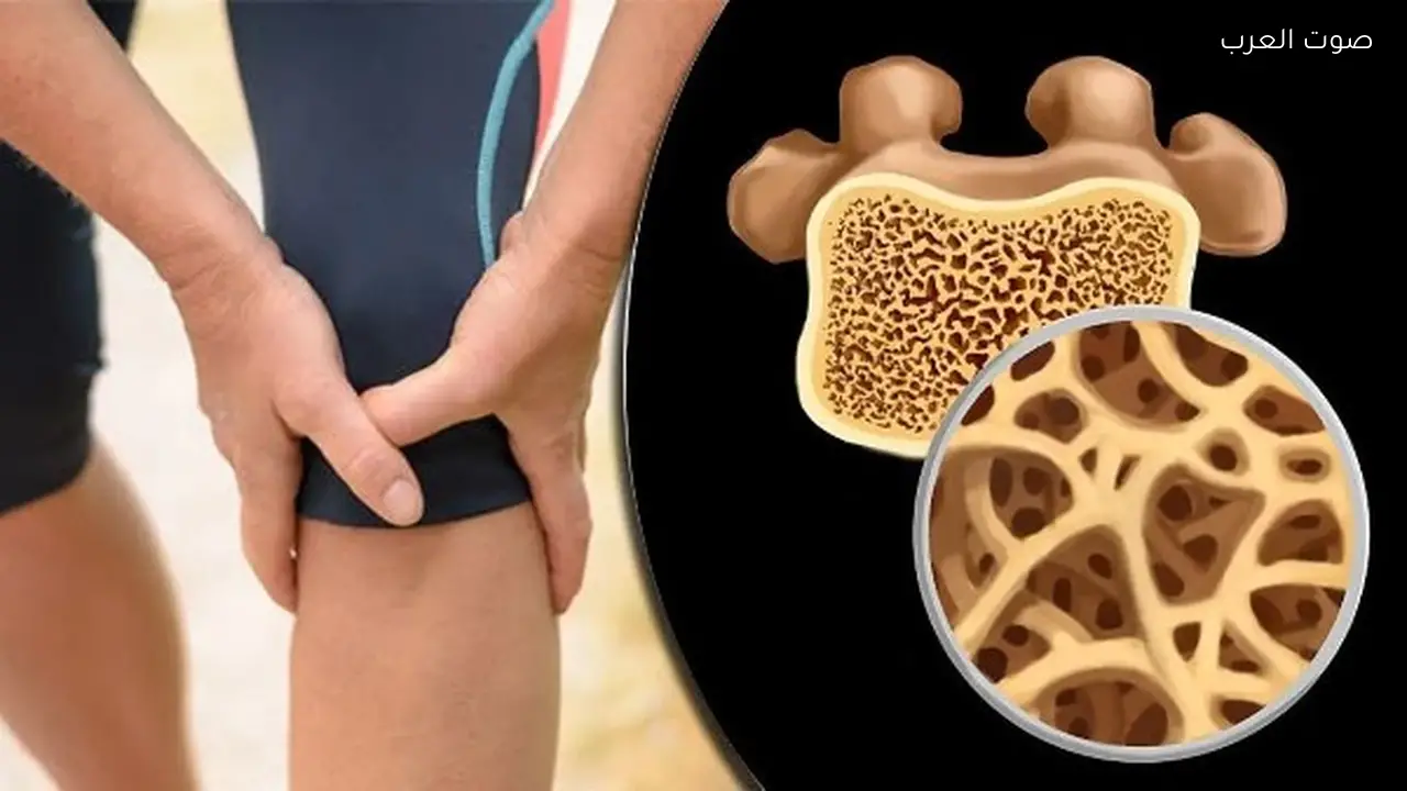 3 هرمونات تؤثر على هشاشة العظام