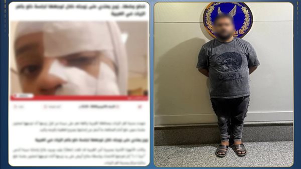 «عايزة تخلعه».. القبض على «مسجل خطر» بالغربية شوه وجه زوجته بسلاح أبيض