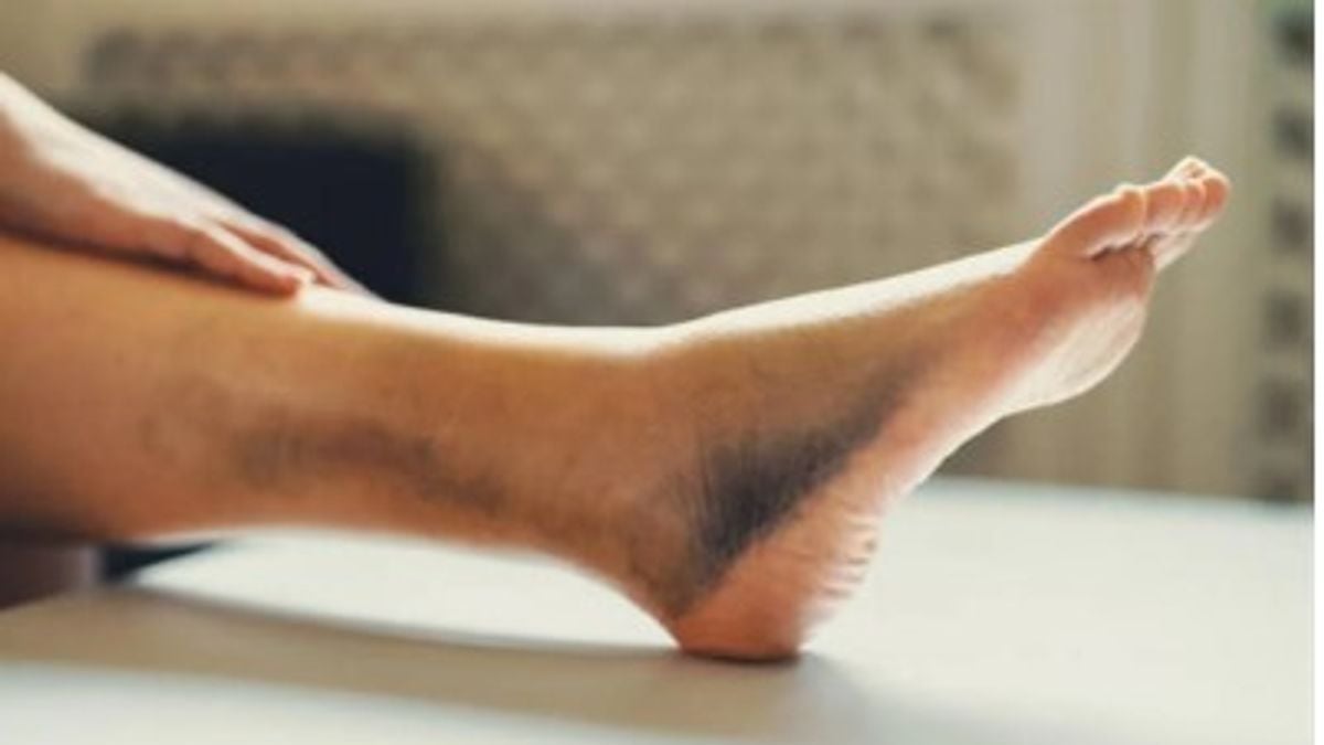 3 نصائح طبية من خالد النمر لتجنب جلطة الساق أثناء الرحلات الطويلة