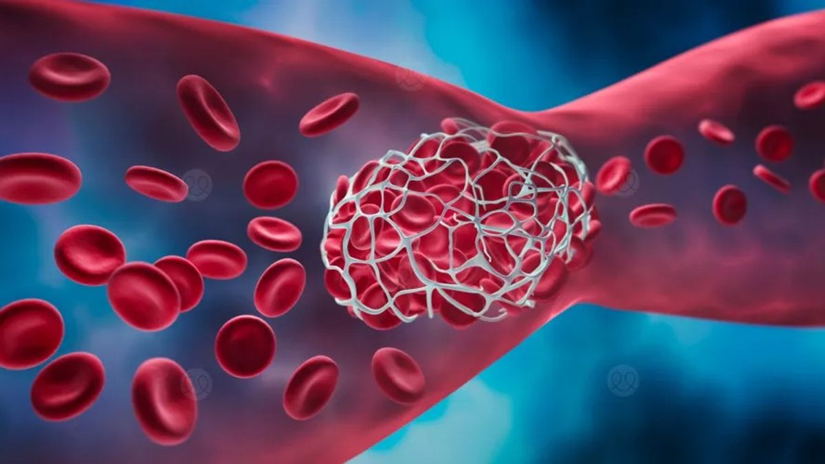 دراسة تشرح آلية اضطراب يؤدي إلى تجلطات دموية خطيرة