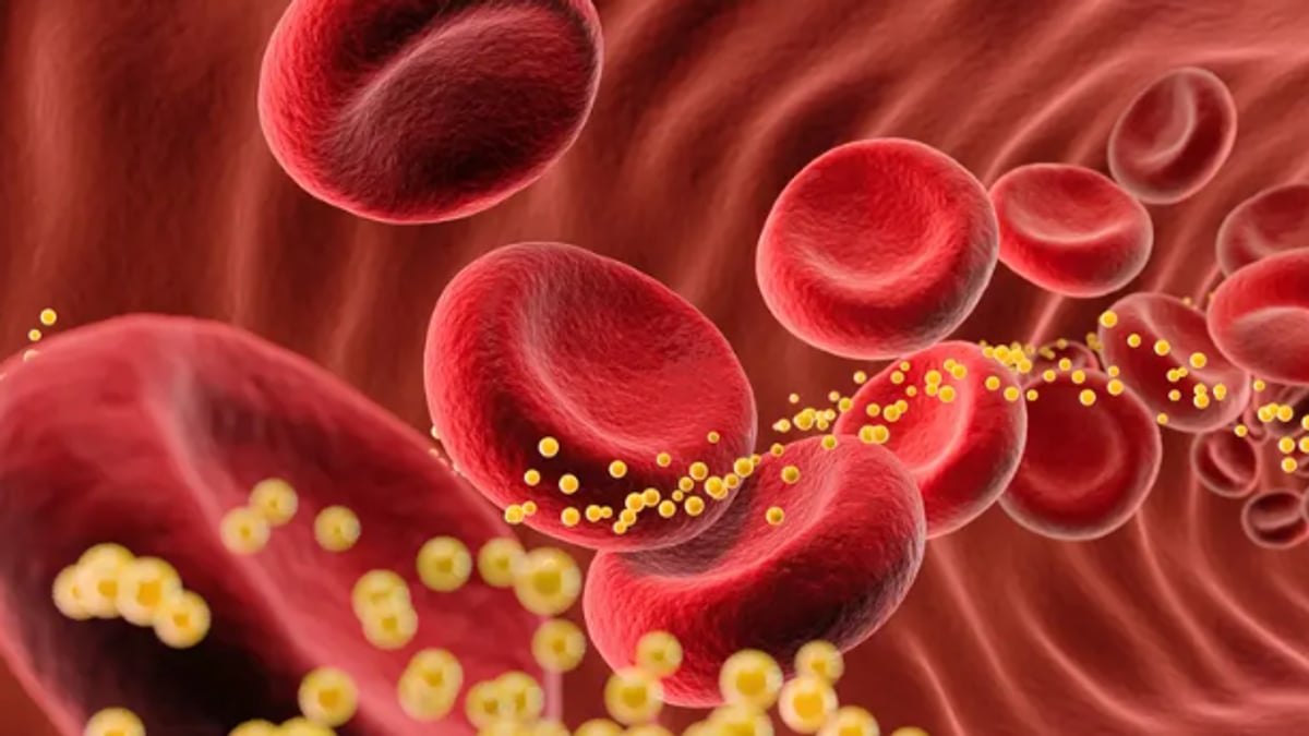 دراسة جديدة تكشف عن علاج جيني يقلل الكوليسترول الضار